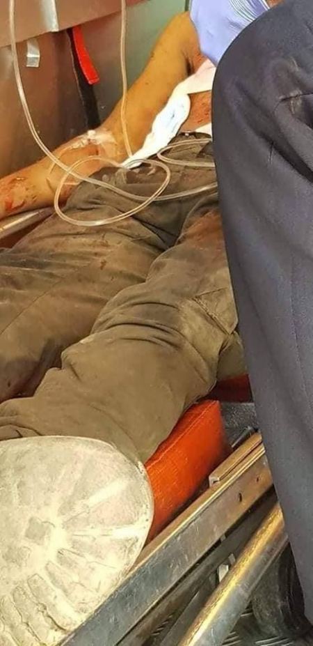 برطعة | تعرض شاب من قفين للطعن جراء شجار 